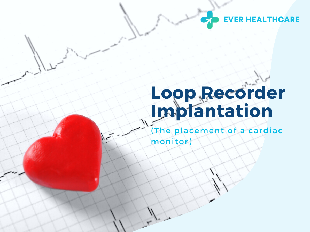 Loop Recorder Implantation in Thailand 2023 Compare Price & Reviews